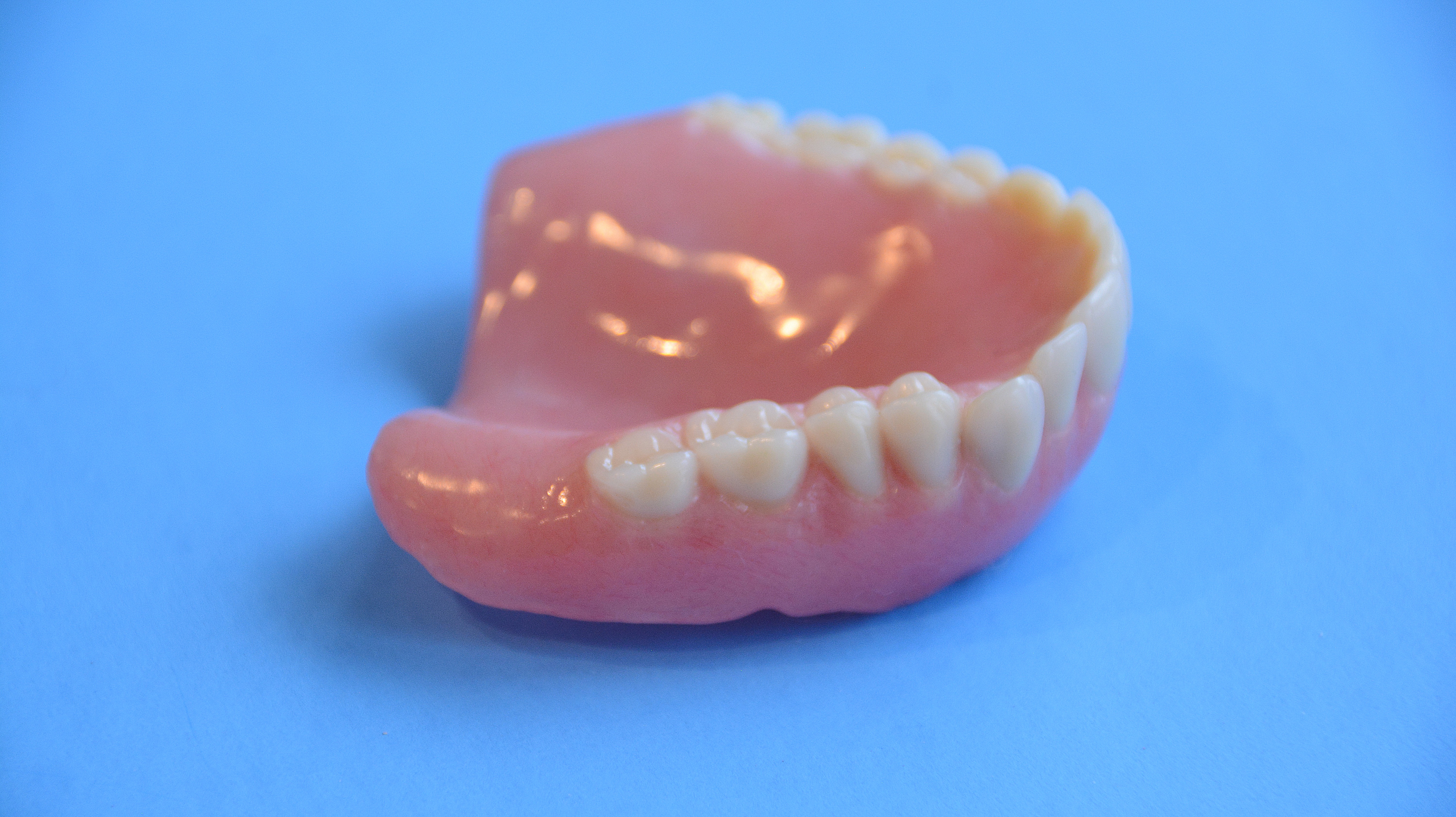 Denture example